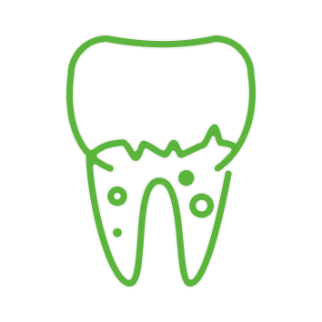 一般歯科・根管治療