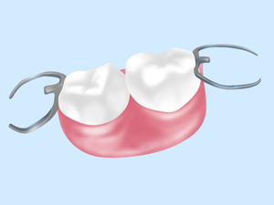 義歯（入れ歯）とは？