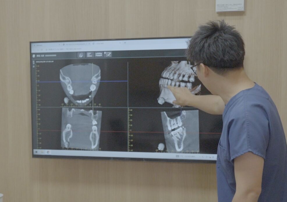 歯科用CT