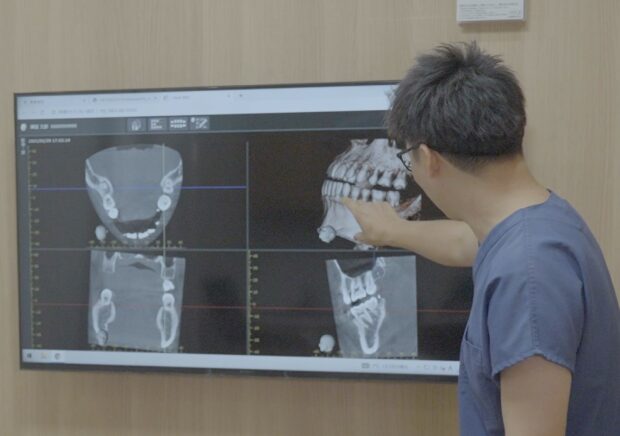 歯科用CT