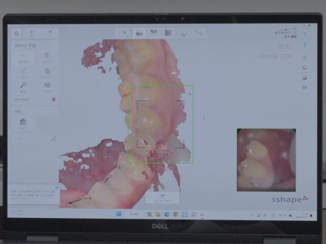 精密な診断・治療を支えるデジタル機器